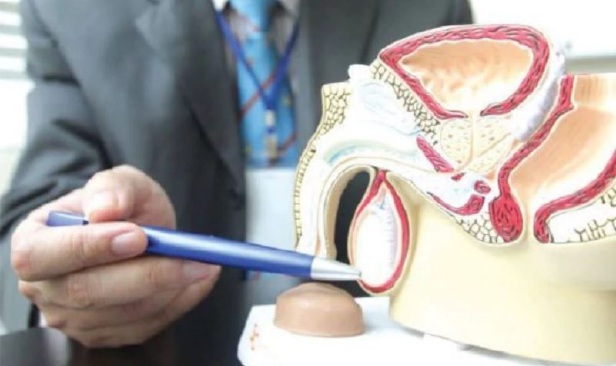 Benjolan tidak menyakitkan mungkin petanda awal, lelaki muda perlu cakna kanser testis