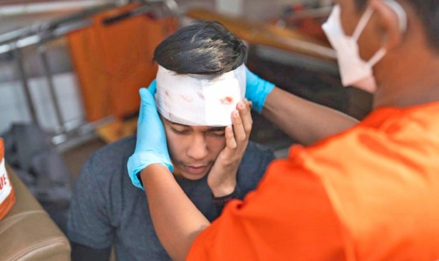 Impak kecederaan kepala